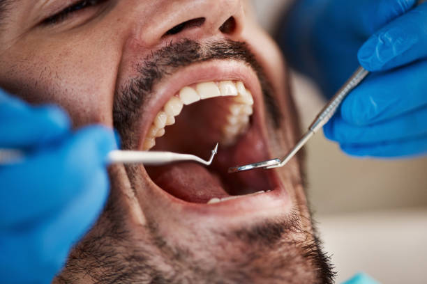 Best Emergency Treatment for Dental Infections or Abscesses in Newton, IL